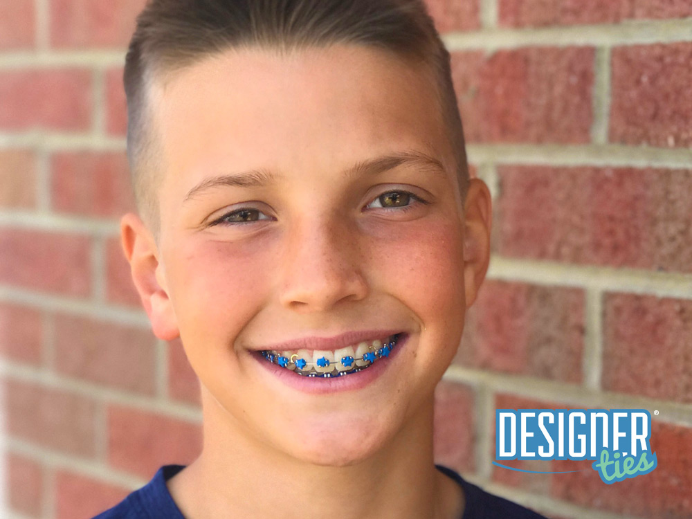 Designer Ties Exclusively from G&H Orthodontics