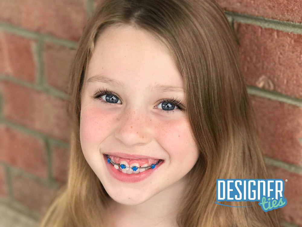 Designer Ties Exclusively from G&H Orthodontics
